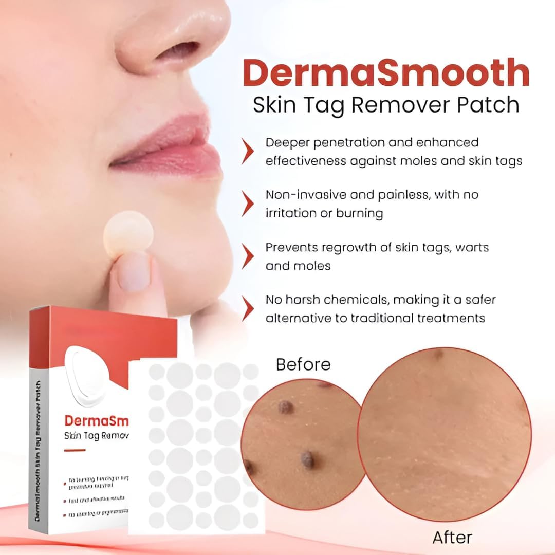 Derma Smooth Skin Tag Removal Patches - 36 Patches - DropSells